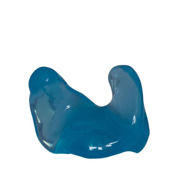 Bouchons anti-eau sur mesure : une solution essentielle pour protéger les oreilles des enfants après la pose d’aérateurs trans-tympaniques